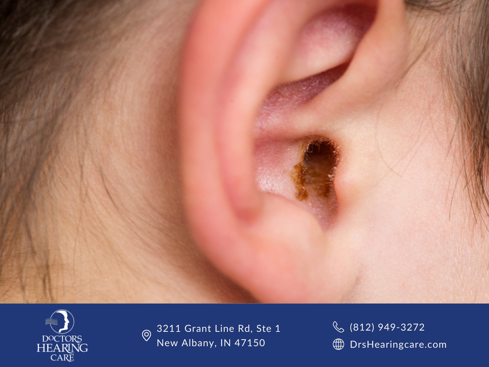 ears with earwax